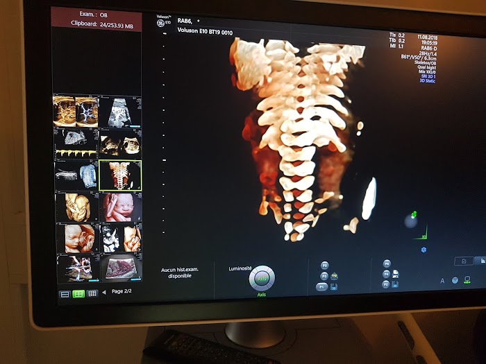 Centre de Radiologie RAYEN, Av. de la liberté, 17, Sfax, Sfax, TN