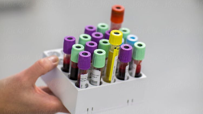 Laboratoire D'analyses Médicales Fenina Ahlem (Labofenina), Ave. de la Republique, 77, Hammamet, Nabeul, TN